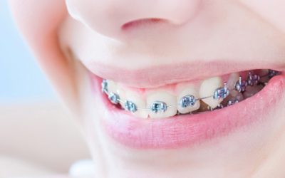 QU’EST CE QUE L’ORTHODONTIE ?